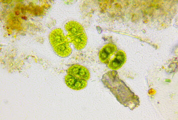 Microscopic view of detritus with algae (Cosmarium) and bacteria. Brightfield illumination.