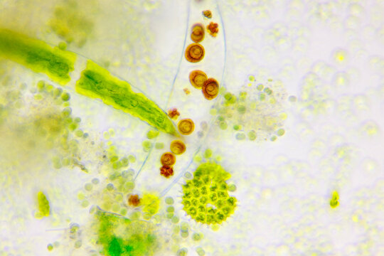 Microscopic view of detritus and different algae. Brightfield illumination.