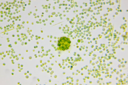 Microscopic view of colonial green algae Coelastrum between single-cell algae. Brightfield illumination.