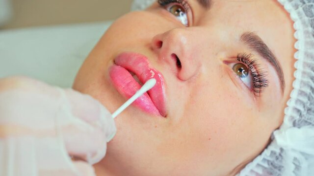 The cosmetologist applies soothing lip balm to the lips with a cotton swab