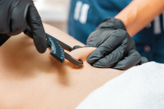 Professional cosmetology in a beauty salon. Beautician measures the fat sediments on the client's belly with a caliper. Close up. Liposuction
