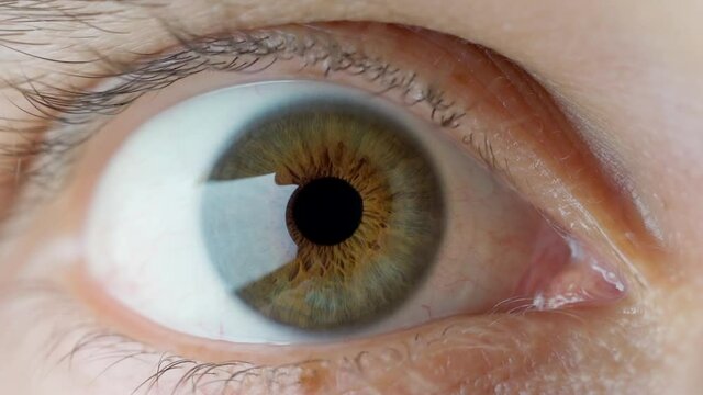 Close-up of Human Eye Pupil Enlargement