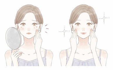 シミに悩む女性のビフォーアフター