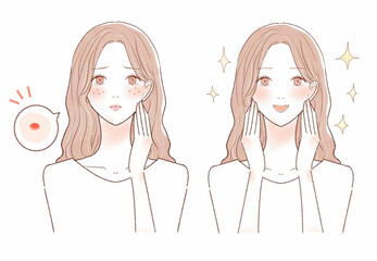 ニキビを気にする女性のビフォーアフター