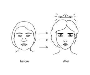Plastic surgery on a woman's face. Silhouette V - line of the face. Vector illustration. 