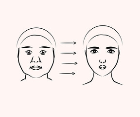 Plastic surgery on a woman's face. Silhouette V - line of the face. Vector illustration. 