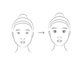 Plastic surgery on a woman's face. Silhouette V - line of the face. Vector illustration. 