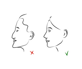 Plastic surgery on a woman's face. Silhouette V - line of the face. Vector illustration.