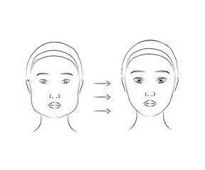 Woman's face on a white background. Plastic surgery. Vector illustration.