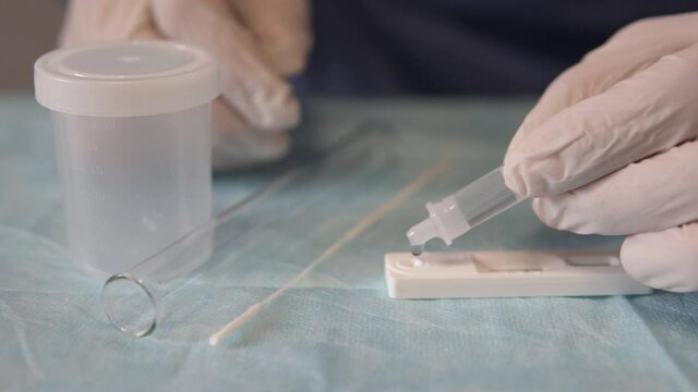 The doctor makes a rapid PCR test for the antigen of the covid-19 virus.