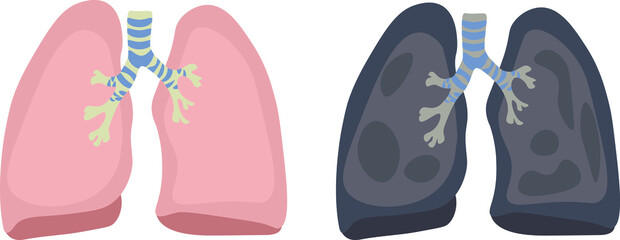 Illustration of the lungs of a healthy person and the lungs of a smoker. Prevention of the development of lung cancer. Smoking kills.