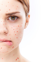 cheerful woman with bare shoulders dermatology pimples