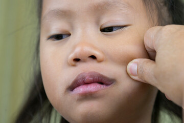 Asian mother and child girl playing pinch cheeks, touch nose funny face.