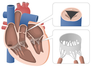 リアルな心臓の断面図