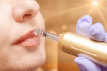 Lip augmentation treatment hyaluron pen device