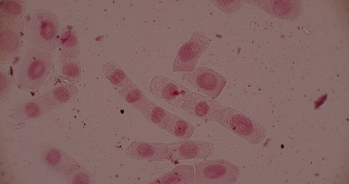 Root tip of Onion and Mitosis cell in the Root tip of Onion under a microscope.
