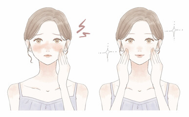 肌の炎症に悩む女性のビフォーアフター