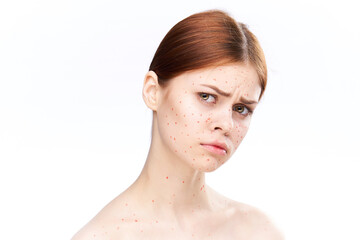 sad woman with bare shoulders red dots on her face