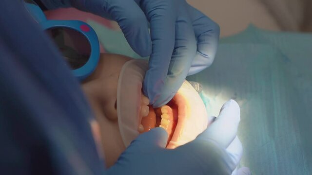 dentist removes from mouth little girl with oral dilator