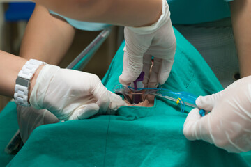 simulation pierced their throat to breathe, Cancer patients are punctured to cure their throat.