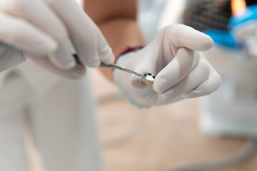 profesional medico odontólogo utilizando herramientas especificas para la labor de dentista con guantes de látex  - obrazy, fototapety, plakaty