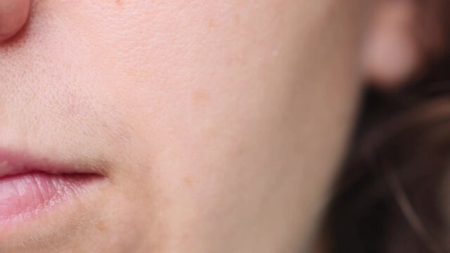 Facial hair of a young girl close-up. problematic skin and vegetation above the lip, mustache and girls.