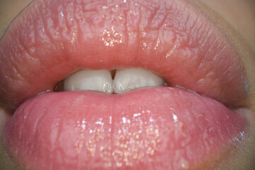 Sensual woman with sensual lips. Close-up perfect natural lip, female mouth. Plump sexy full lips. Macro face detail. Sensual forms of woman lips.