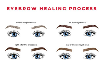The eyebrow healing process after permanent makeup. Illustration brows with eyes - obrazy, fototapety, plakaty