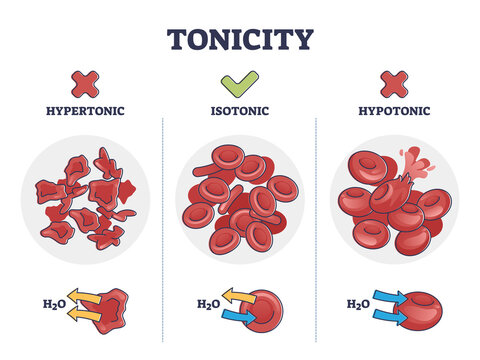 Tonicity as osmotic hypertonic, isotonic, hypotonic pressure outline diagram. Labeled educational comparison with water concentration in red blood cells vector illustration. Liquid exchange balance.