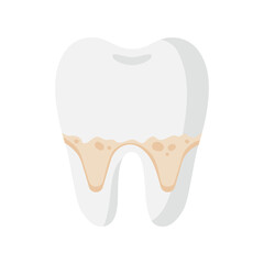 Vector cartoon tooth with dental root plaque and tartar disease.