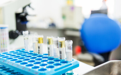 Rack of tubes and laboratory microscope