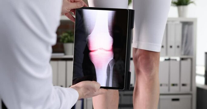 Doctor traumatologist scanning woman sore knee using digital tablet in clinic 4k movie slow motion