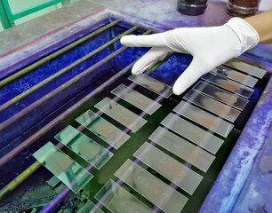 Technician staining hematological slide for microscopy.