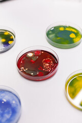 Close up of petri dish on laboratory desk at clinic. Professional instruments of glass plates with bacteria and virus prepared for microscopic analysis in biochemistry cabinet