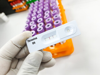 Scientist holding rapid screening test cassette for Parvovirus B19 test at medical laboratory. To...