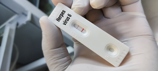 Rapid test cassette for Herpesvirus 6 test, roseola, positive result showing, close focus view