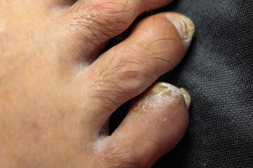 Hazardous chemicals corrosive the toe