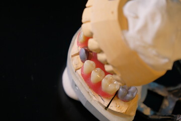 Dental technician works by brush with jaw model