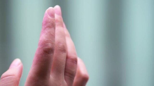 Macro closeup of isolated female index finger skin of young woman's hand showing eczema medical condition called dyshidrotic pompholyx or vesicular dyshidrosis with blisters