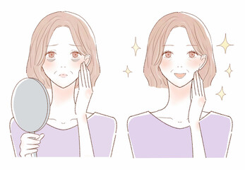 血行不良による目の下のクマに悩む中年女性のビフォーアフター