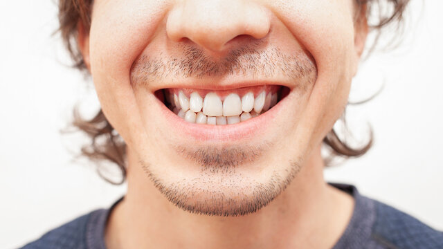 Close up portrait smile teeth man. white beautiful teeth after whitening, alignment