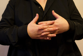 Women's palms are clasped, thumbs raised, on a black background. Symbol, sign.