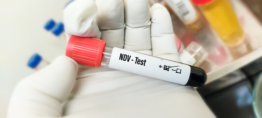 Blood sample tube with positive sample for NDV or Newcastle disease virus test, infection of domestic poultry and other bird species