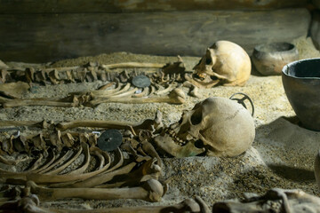 A human skull and the remains of bones in the museum.