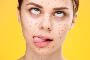 woman with red dots on her face skin problems dermatology dissatisfaction