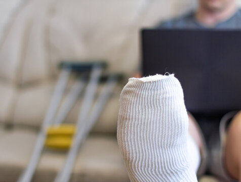 A man sits on a sofa in a cast with a laptop. A leg in a cast lies on a chair.
