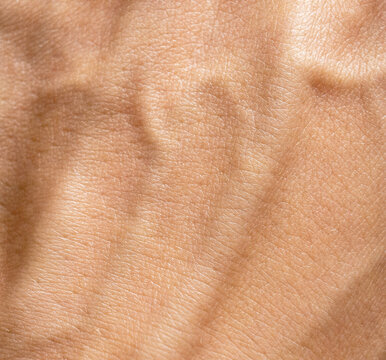 Skin texture ,veins