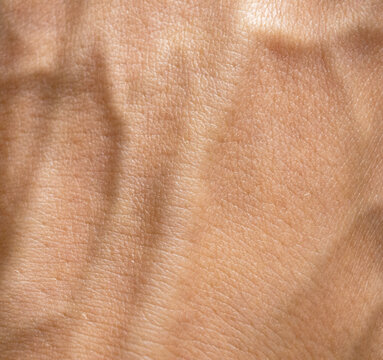 Skin texture ,veins