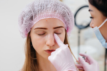 Cosmetic procedure for filling the nasolacrimal furrow and mesotherapy around the eyes for a young...