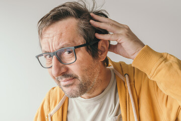 Hair loss, man looking at the mirror concerned about losing his hair at forehead